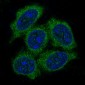 Anti-Hsp70 HSPA1A Rabbit Monoclonal Antibody